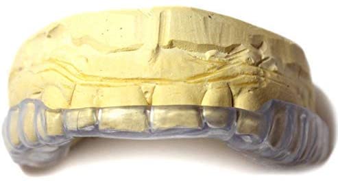 Best Pick: J&S Dental Lab Custom Dental Night Guard for Upper Bite Guard